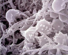 tooth plaque bacteria